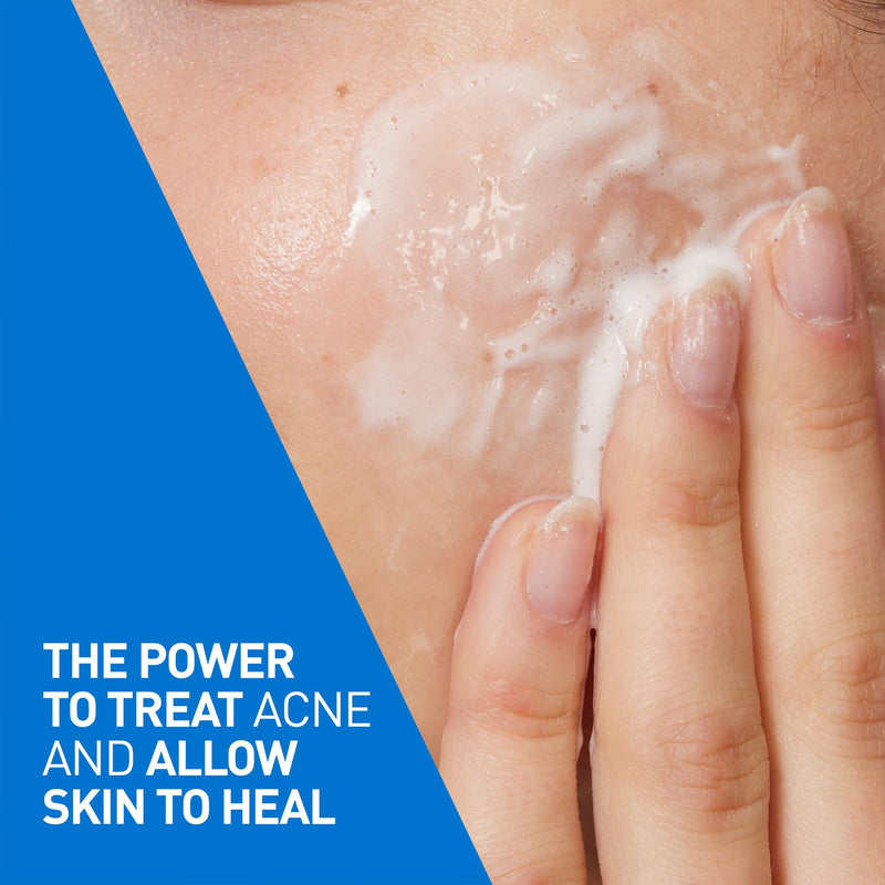 CeraVe - Acne Foaming Cleanser - 4% Benzoyl Peroxide - 150 mL