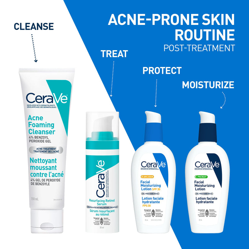 CeraVe - Acne Foaming Cleanser - 4% Benzoyl Peroxide - 150 mL