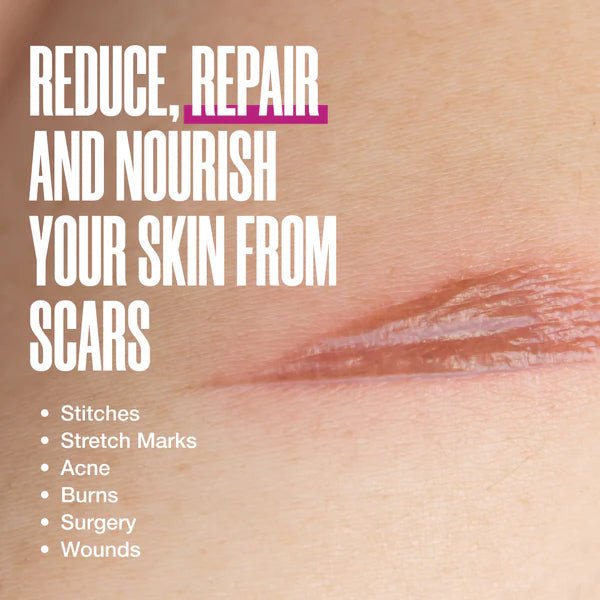 Zax's - Scar Fading Cream 28g - Limolin 