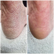 LOVASKIN – Instant Foot Peel | 1 fl oz / 30 mL – additional view